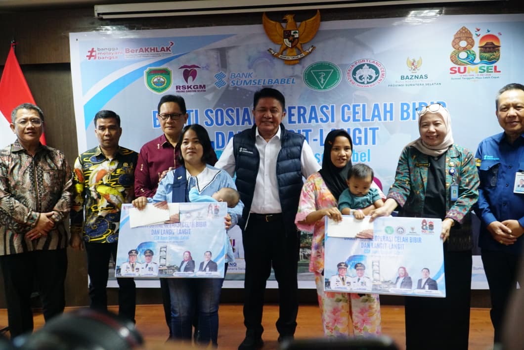 HUT Sumsel ke-80: Herman Deru Hadiri Bakti Sosial Operasi Bibir Sumbing di RSGM Provinsi